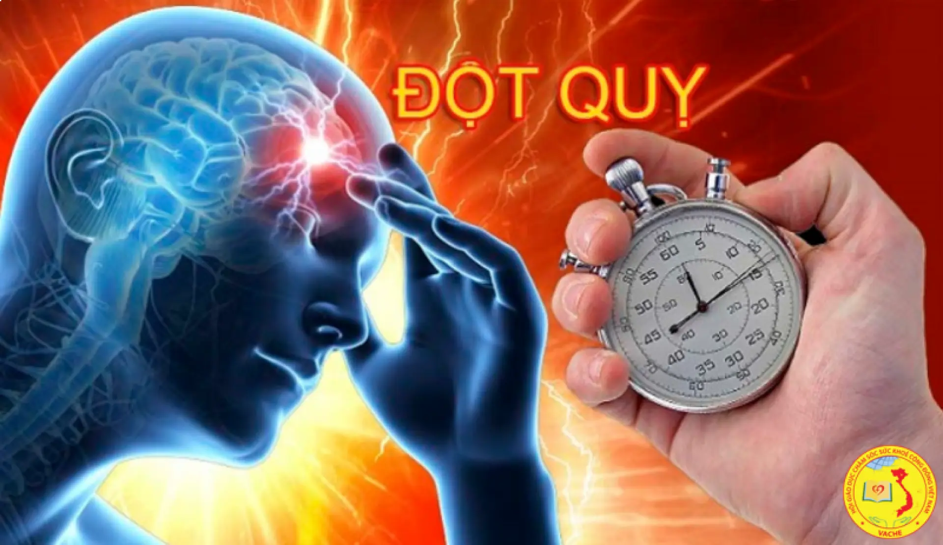 Vì sao đột quỵ đang trẻ hóa – và làm gì để nhận biết, phòng tránh một cách khoa học?